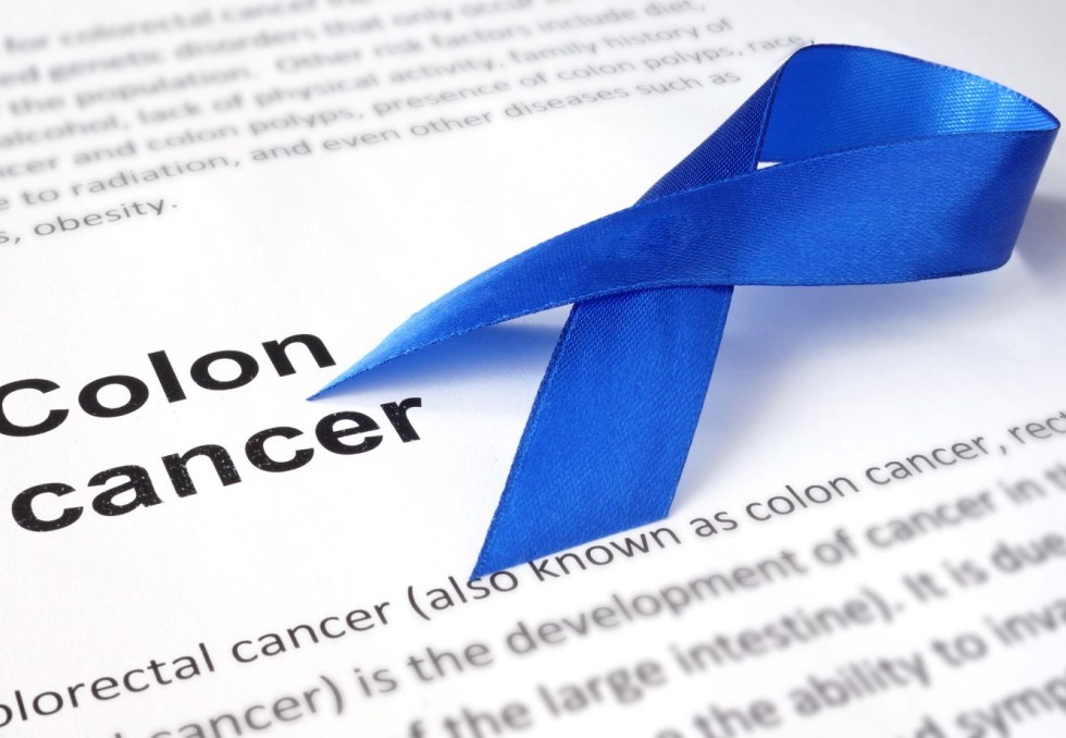 Cancer du colon