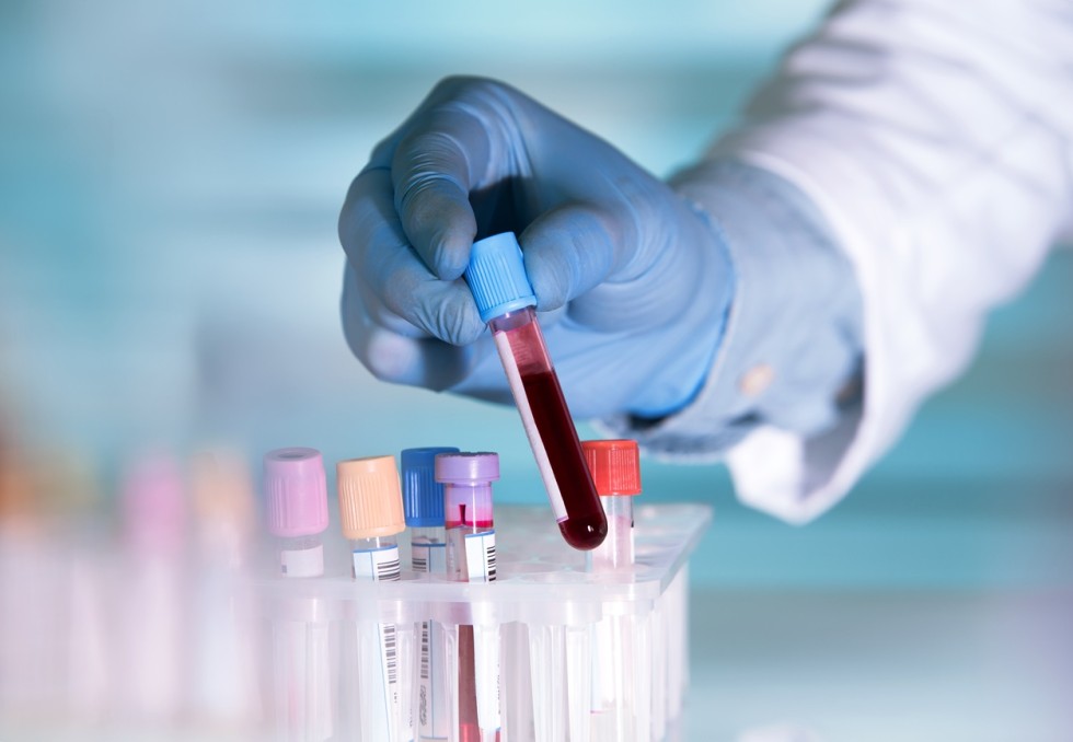biologie médicale