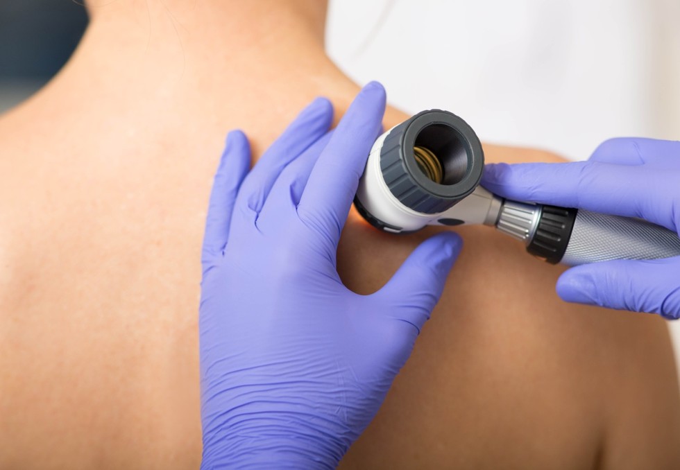 dermatologie