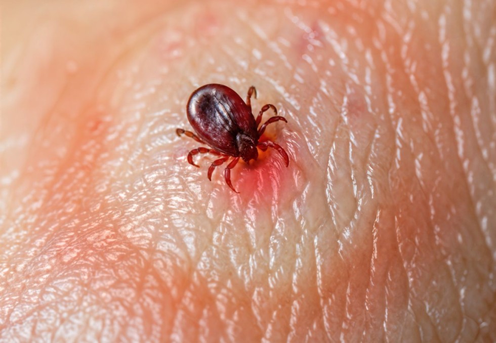 lyme