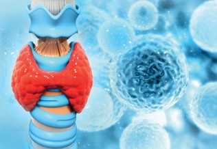 Hypothyroïdie : un diagnostic par étape