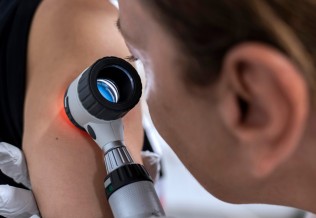 dermatoscope