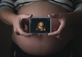 échographie 3D