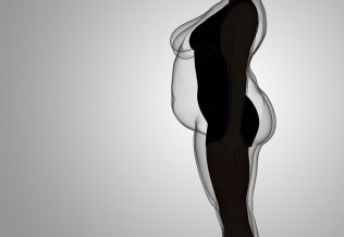 obésité