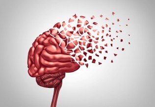 Cerveau