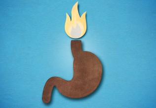 reflux