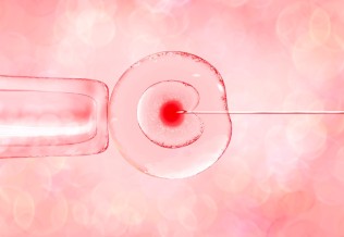 ovocyte