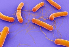 Bacillus cereus 