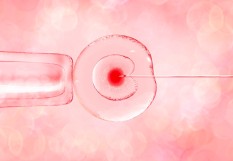 ovocyte